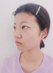 -深圳悦她医疗美容