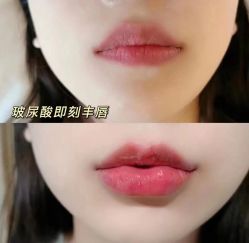 -AiCure 埃可儿·韩国医学皮肤管理