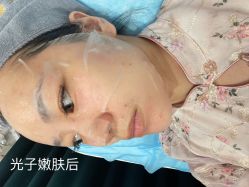 -澳尔颜选医疗美容