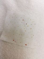 -苗方清颜祛痘·皮肤管理