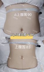 -Lily纤美·科技减脂中心