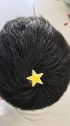 -大麦微针植发丨全国连锁