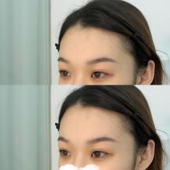 -张小野·专业半永久纹眉