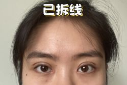 -素美医疗美容·西南眼鼻整形·修复基地