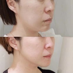 -LUNA皮相美·骨相美高级美感
