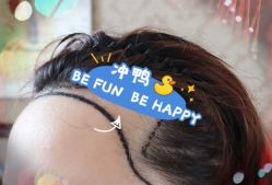 -大麦微针植发全国连锁