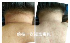 -升艾堂亚健康调理中心