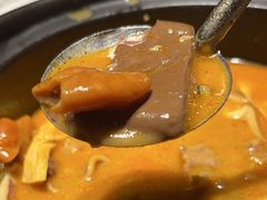 -宋小谨(惠安禹洲店)