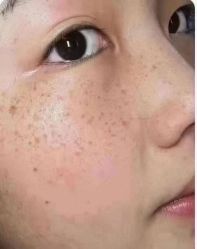 -+MS卓美丝专业祛痘·皮肤管理中心