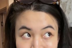 -天津健丽·去眼袋医疗美容机构