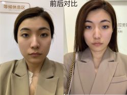 点击看大图 体验后-和颜一美轻医美连锁