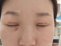 -杭州美莱医疗美容医院