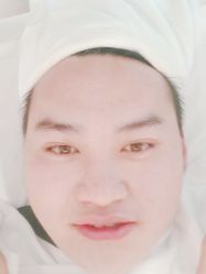 -塑青春&伊肤泉祛痘皮肤管理