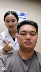 体验后-大麦微针植发全国连锁