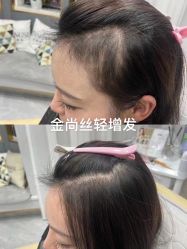 -金尚丝接发