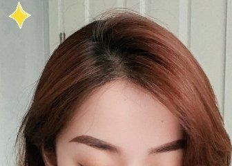 -大麦微针植发丨全国连锁