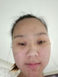 体验后-上海玫瑰医疗美容医院