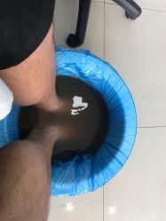 -德哥灰指甲脚气甲沟炎跖疣护理