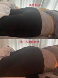 点击看大图 -科技美容&形体美修斯瘦身中心