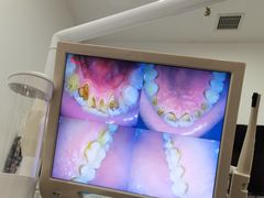 -土豆口腔(凤凰北总店)