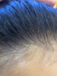 -熙朵美学植发·连锁品牌