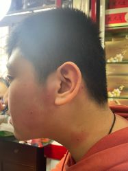 -北京美痣堂古方祛痣斑疣瘊