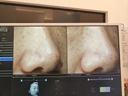 点击看大图 -苑苑vbeauty科技美容SPA