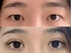 -Yestar 嘉兴艺星医疗美容医院