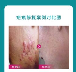 -薇薇安花系SPA