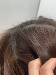 -熙朵美学植发·连锁品牌