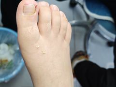 -世龙世家甲沟炎·灰指甲·嵌甲矫正·修脚(武侯区双楠店)