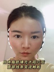 -Yestar宁波艺星整形医院