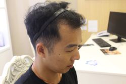 点击看大图 -大麦微针植发丨全国连锁