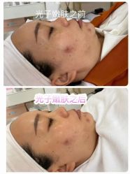 -凡碧诗毛孔清洁收细