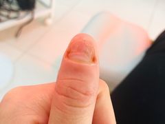 -新甲连锁灰指甲·甲沟炎·鸡眼(黑龙江路店)