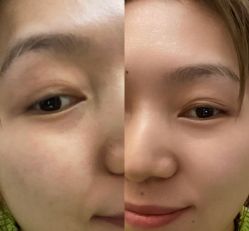 体验前-成都西区医院整形美容