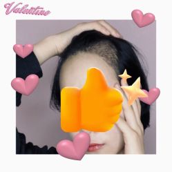 -大麦微针植发丨全国连锁