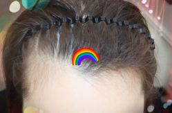 -大麦微针植发全国连锁