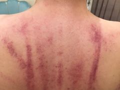 -艾通康缘艾灸.疼痛.睡眠养生馆(凤凰城店)