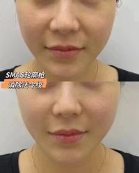 -栖SPA·ONDA ·海菲秀·皑皑科技美肤中心
