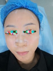 体验后-瑞鑫创美·高定轻医美