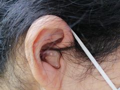 -海之声助听器无锡旗舰中心·儿童验配中心