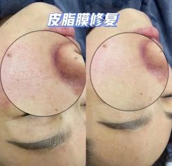 -LUNA皮相美·骨相美高级美感