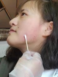 -痣缘宫