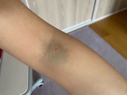 -北京大学第一医院妇产儿童医院