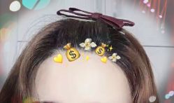 -大麦微针植发全国连锁