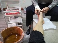 -祖传修脚甲沟炎灰指甲鸡眼