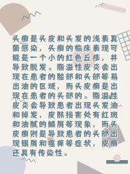 -碧莲盛·不剃发植发