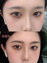 点击看大图 -OnFaer.纹眉半永久无创洗眉
