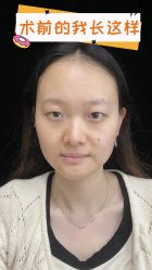 -素美医疗美容·西南眼鼻整形·修复基地